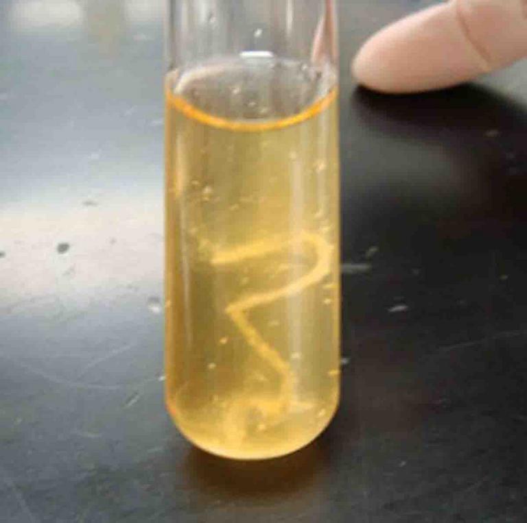 Use Of Liquid Nutrient Broth Media For Growing Bacteria Page 2