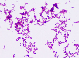 Bacterial Staining Microbiology Images: Photographs and Videos of Gram ...